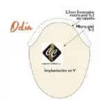 Prótese ODIN M-Skin Instant´Hair Capel-lo ( XTS ) - Image 2