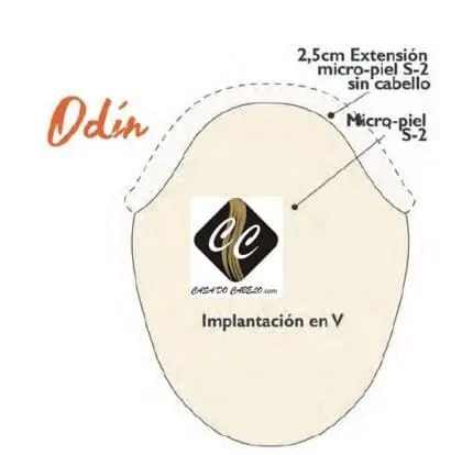 Prótese ODIN M-Skin Instant´Hair Capel-lo ( XTS ) - Image 2