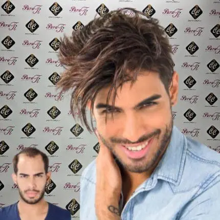 Prótese Capilar JÚPITER Instant Hair Aderans (Base M-Full Cap) - Image 2